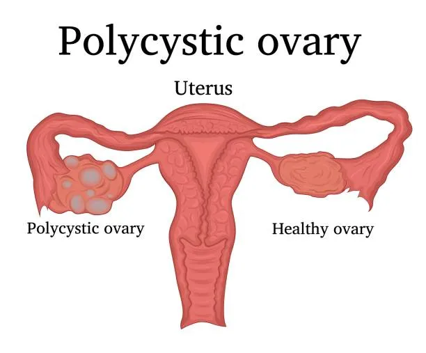 Polysystic treatment in marine line