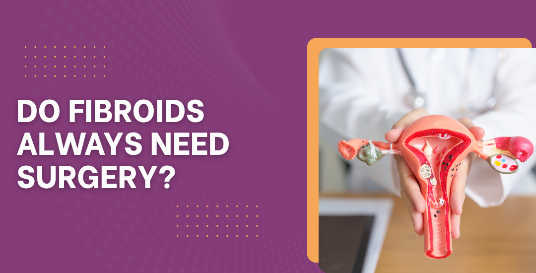 Do Fibroids Always Need Surgery