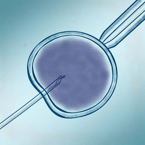 Close-up of a round oocyte held by two glass pipettes, with a thin needle approaching for microinjection (fertilization) procedure.