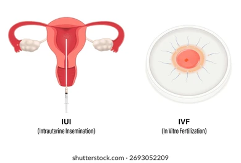 Infertility Treatment