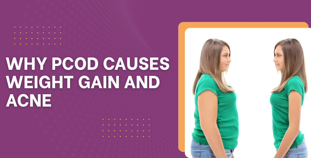 Why does PCOD cause weight gain and acne?