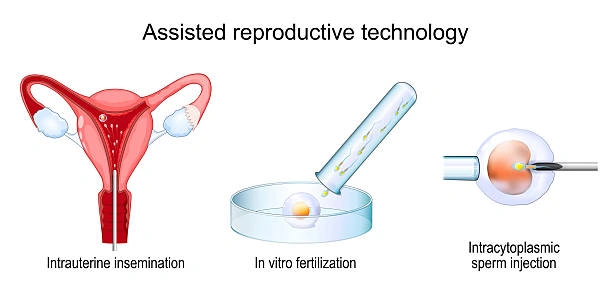 What Are Vaginal Infections and Why Should You Get Treated?