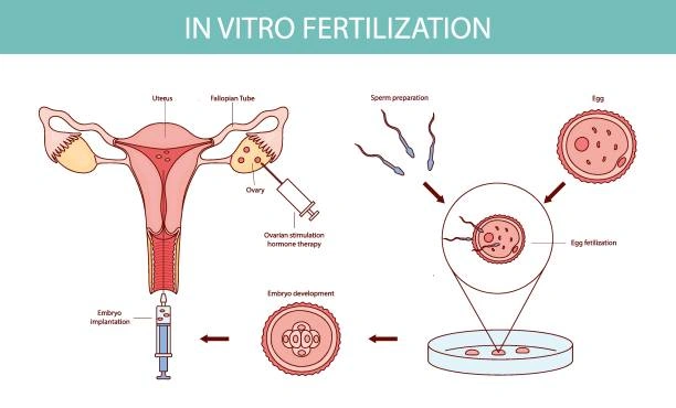What Are Vaginal Infections and Why Should You Get Treated?