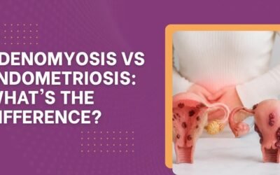 Adenomyosis vs Endometriosis: What’s the Difference?