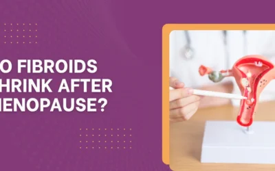 Do Fibroids Shrink After Menopause?
