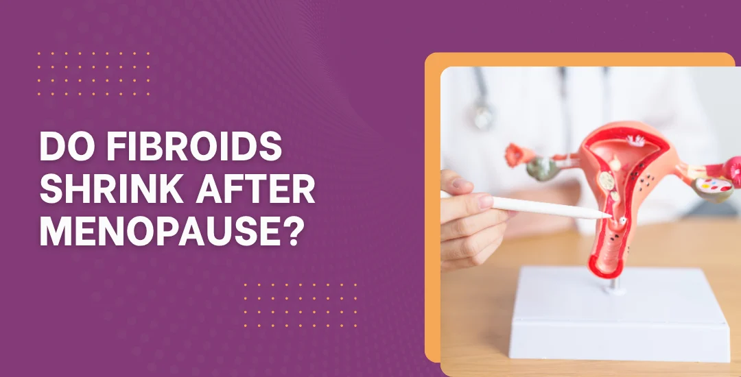 Do Fibroids Shrink After Menopause