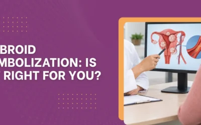 Fibroid Embolization: Is It Right for You?