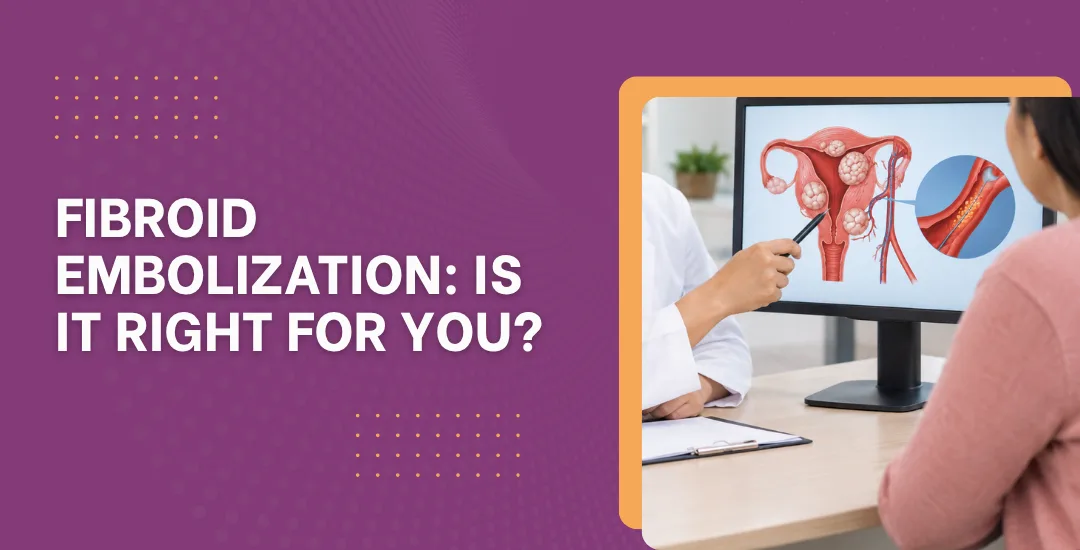 Fibroid Embolization: Is It Right for You?