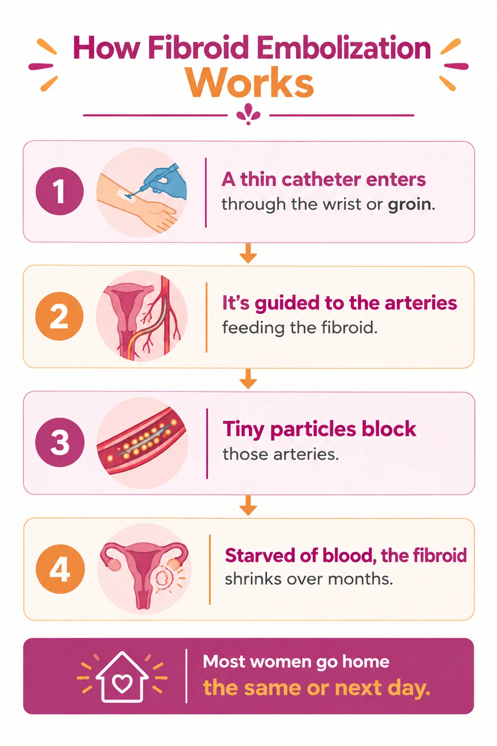 How Does Uterine Fibroid Embolization Work